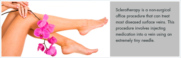 Sclerotherapy-Spider and Varicose Vein Treatment